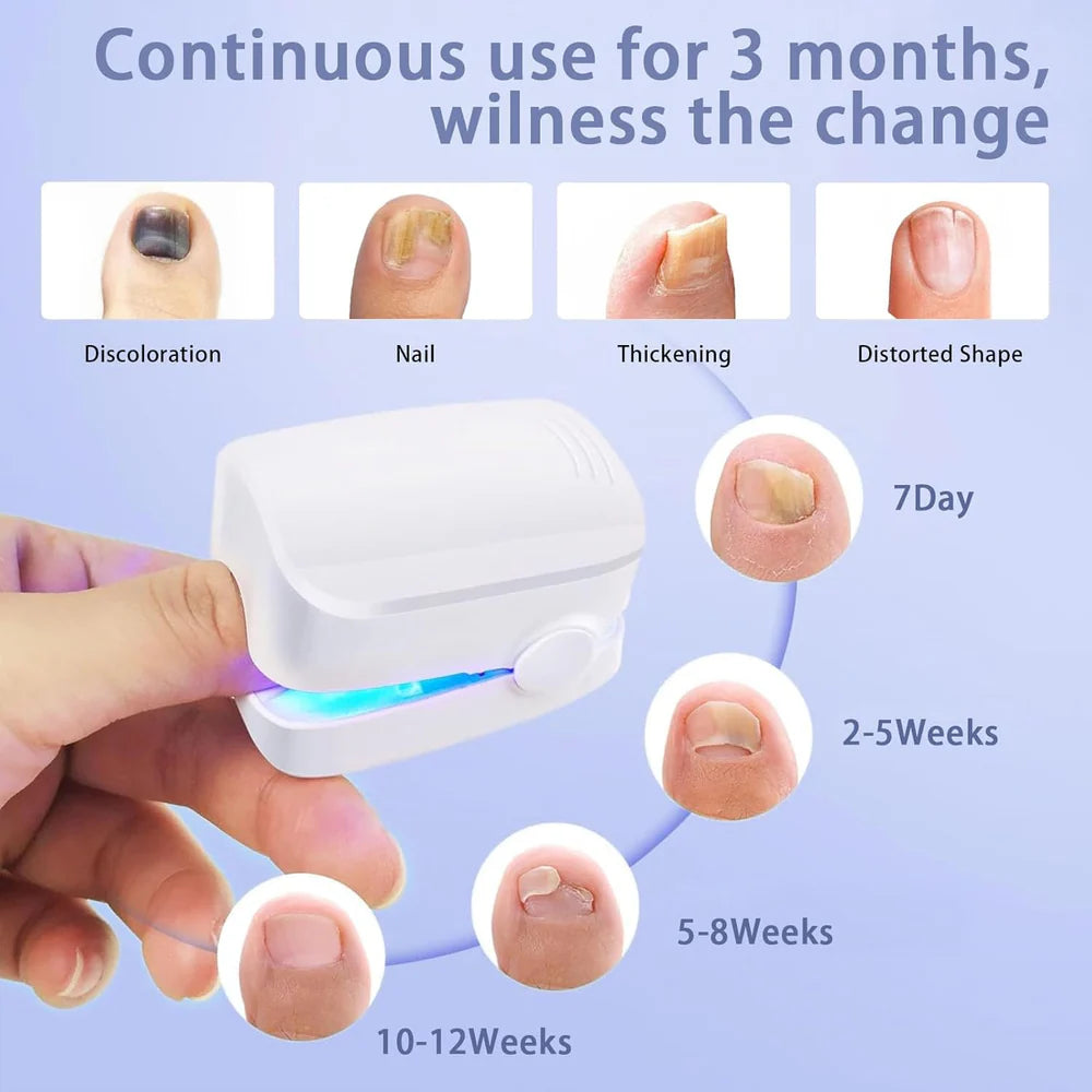 Light-Activated Nail Care Device for Fingernails and Toenails