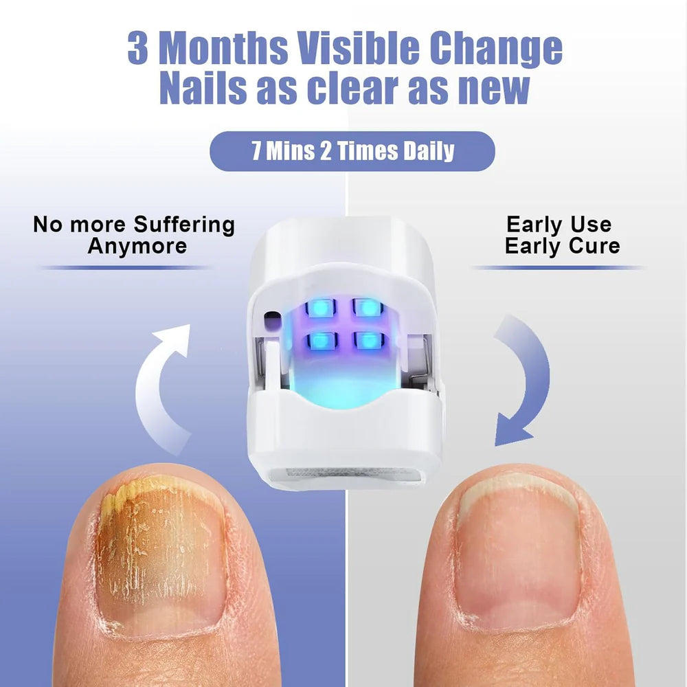 Light-Activated Nail Care Device for Fingernails and Toenails