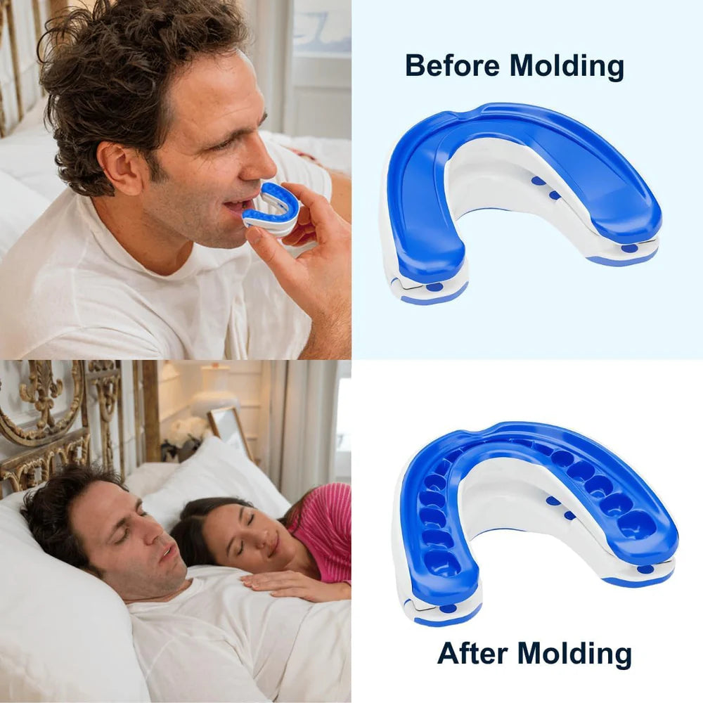 VitalSleep Personalized Anti-Snoring Mouthpiece